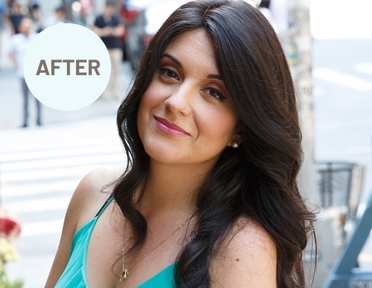 photo-gallery-womens-hair-systems-before-after Photo Gallery