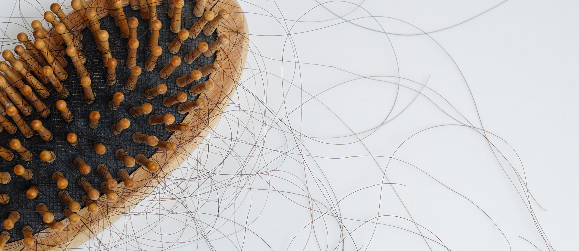 Hair Loss and Mental Health: Why the Right Solution Can Transform More Than Just Your Appearance