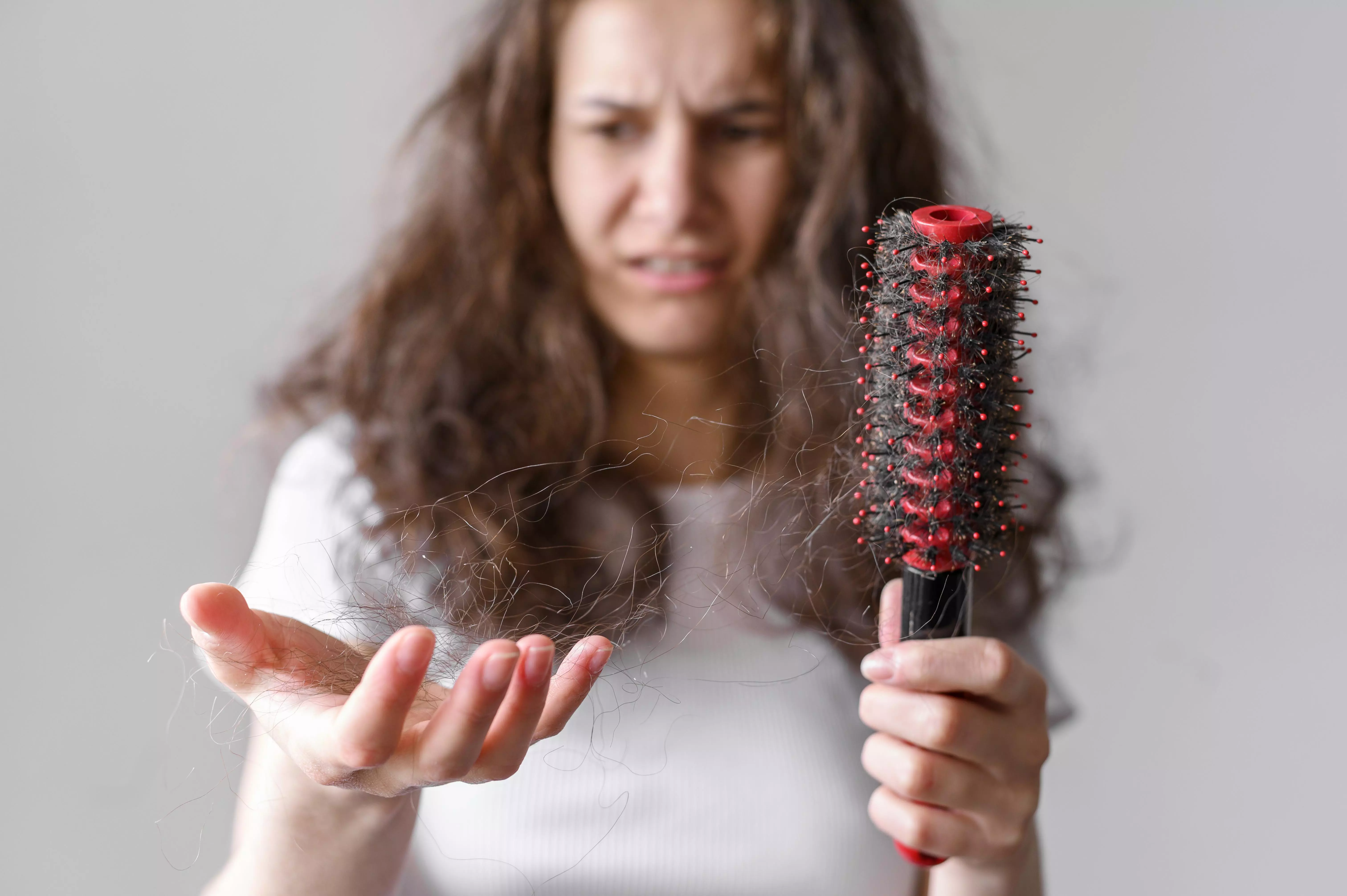 What Causes Hair Loss in Women?