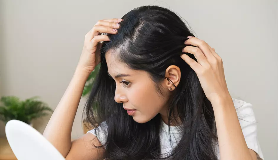 Hair Toppers Explained: A Simple Solution for Thinning Hair