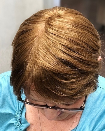 Toppers: Before & After Photo Gallery | Bravadas Wigs Toppers: Before & After Photo Gallery | Bravadas Wigs
